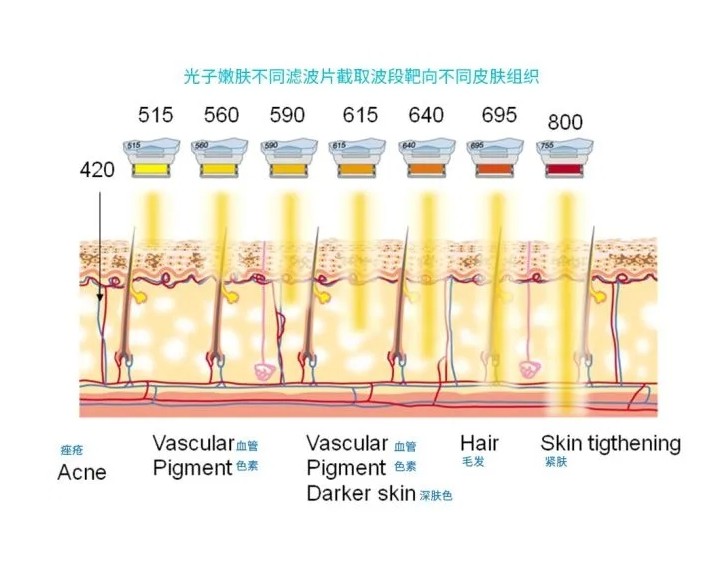 五大光子嫩膚技術(shù)（IPL、DPL、OPT、APT、BBL）及濾光片區(qū)別